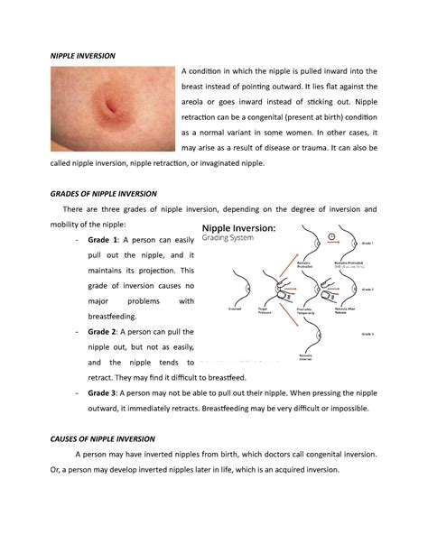 Nipple Inversion Nipple Inversion A Condition In Which The Nipple Is Pulled Inward Into The