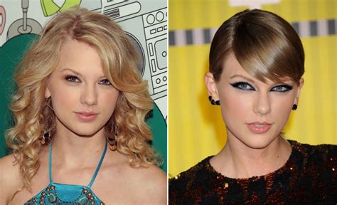 Taylor Swift Before And After Celebrity Plastic Surgery Plastic Surgery Taylor Swift