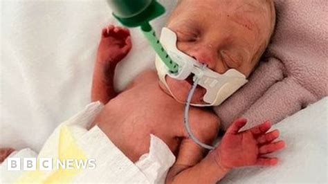 Baby Born 16 Weeks Early On Holiday Flown Home To Devon Bbc News