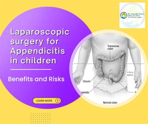 Laparoscopic Surgery For Appendicitis In Children Benefits And Risks