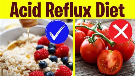 Acid Reflux Diet 7 Foods To Eat And To Avoid Youtube