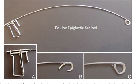 Treatment Of Epiglottic Entrapment By Transnasal Axial Division In