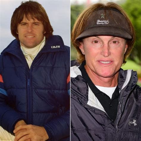 Bruce Jenner Plastic Surgery Before And After New Face Star Plastic Surgery