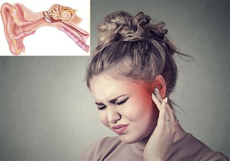 Labyrinthitis Symptoms Causes And Treatment