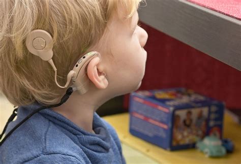 How Much Does Cochlear Implants Cost Sign Station