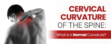 Cervical Curvature Of The Spine What Is A Normal Curvature