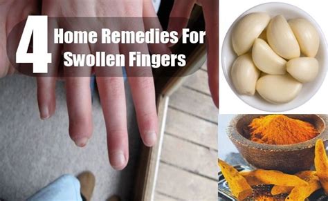 4 Home Remedies To Treat Swollen Fingers Home Remedies Swelling Remedies Remedies