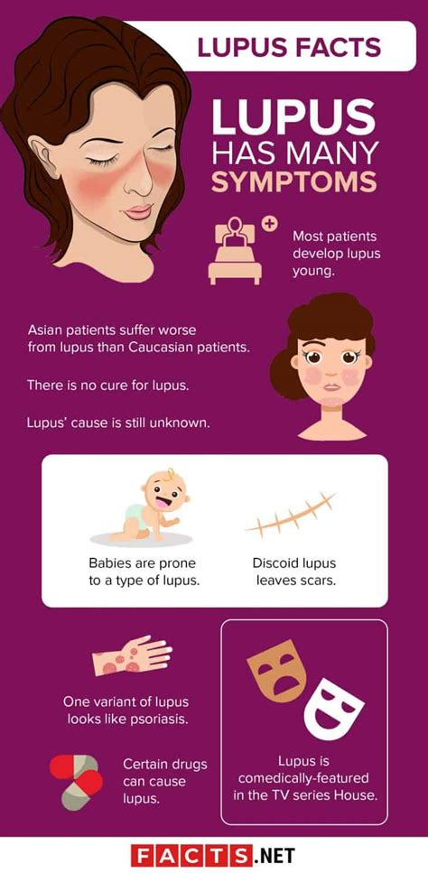 30 Facts About Lupus That You Really Should Know About