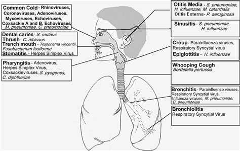 Respiratory Tract Infections Upper Respiratory Tract Infections