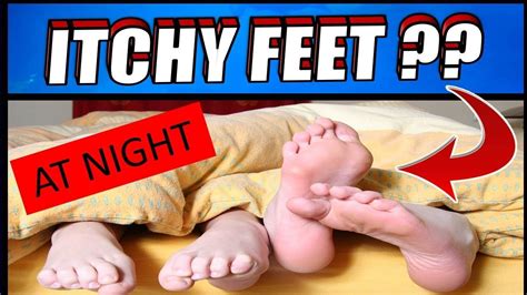 Why Do I Get Itchy Feetskin At Night How To Get Rid Of Itchy Feet Youtube