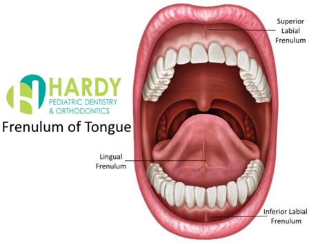 What Is Frenulum Of Tongue Hardy Pediatric Dentistry Orthodontics