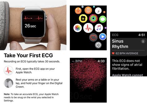 Hand And Heart On Apple Watch Series 4s Ecg App By Lance Ulanoff