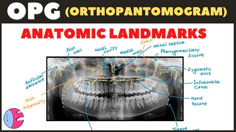Anatomical Landmarks On Panoramic X Ray