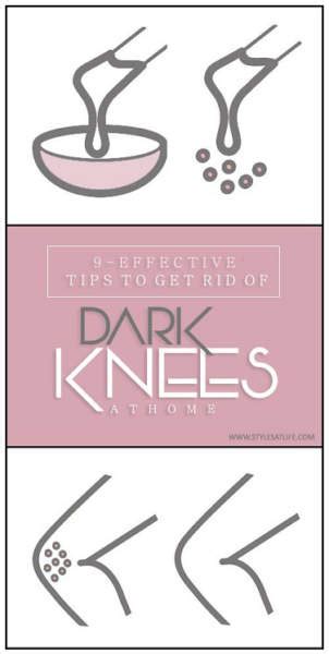 9 Effective Tips To Get Rid Of Dark Knees At Home Styles At Life