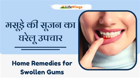 Home Remedy Swollen Gums मसूड़ों की सूजन से राहत दिलाएंगे 7 प्राकृतिक