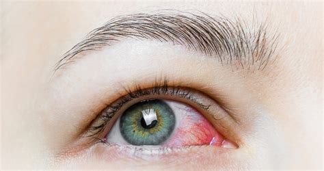 Coronavirus Vision Symptoms And Safety Practices Florida Eye Specialists