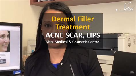 Dermal Filler Treatment To Acne Scars Cheeks Lips Forehead Risk