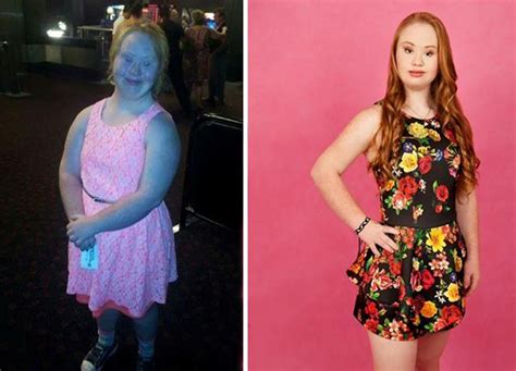 Madeline Is An Inspiring Babe Woman With Down Syndrome Who Wants To Be A Model Art Sheep