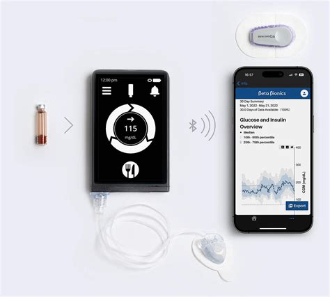 An Automated Solution Simplifying Diabetes Control With The Ilet