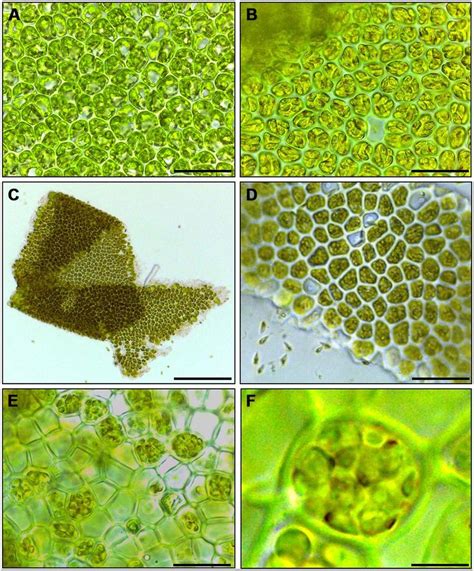 Ulva Lactuca Microscope Frontiers Regulation Of Gametogenesis And