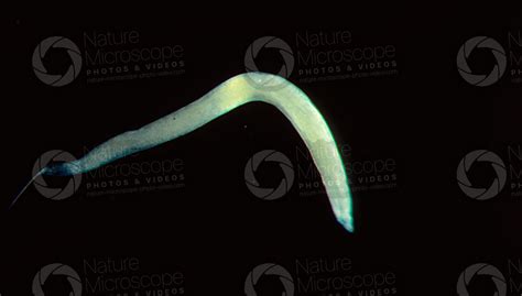 Enterobius Vermicularis Pinworm Enterobiasis Nematoda Nematodes