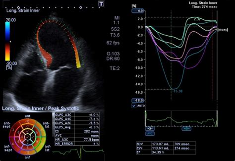 Cardiology Ultrasound Canon Medical Systems Ltd