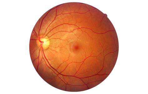 Imaging Retinico Come Funziona E Perché S Important Visionary Eye Centre Kompremos