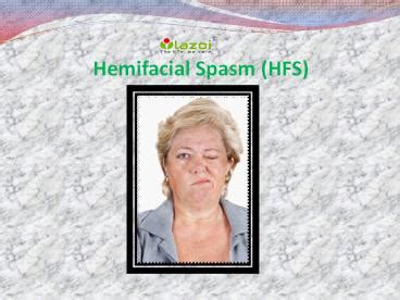 Ppt Hemifacial Spasm Overview Of Symptoms Causes And Treatment