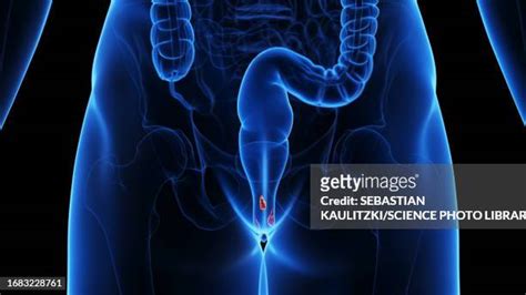 Haemorrhoids Photos And Premium High Res Pictures Getty Images