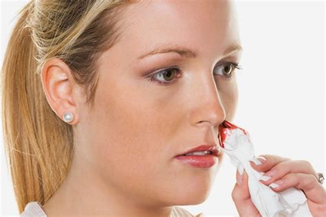 The Causes Of Nosebleed In The Spring And Its Treatment