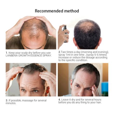 According to the latest data. LANBENA Hair Growth Essence Spray Anti Hair - GearBeauty
