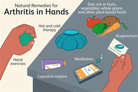 10 Ways To Naturally Manage Arthritis In The Hands 2022