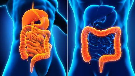 3 Key Difference Between Crohns Disease And Ulcerative Colitis