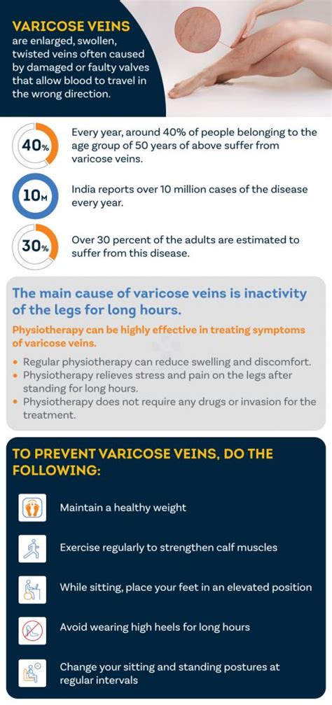 How Physiotherapy Helps In Treating Varicose Veins Pristyn Care