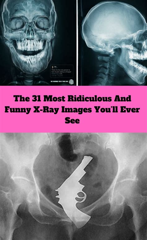 Meme X Ray Memes Funny Picture Jokes Vision Comic The Best Porn Website
