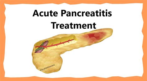 Acute Pancreatitis Treatment Acute Pancreatitis