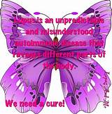 Best Lupus Doctors