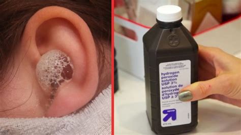How To Use Hydrogen Peroxide To Combat Ear Infections And More
