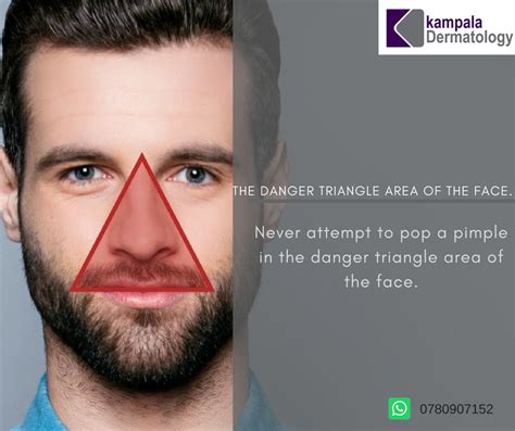 The Danger Triangle Area Kampala Dermatology Skin Clinic Facebook