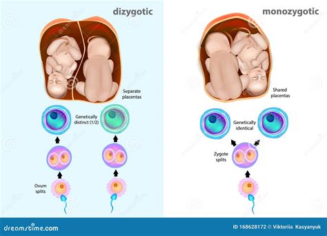 Monozygotic Or Dizygotic Twins Stock Vector Illustration Of Newborn