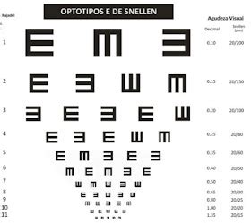 Optometria no Brasil Exames de Acuidade Visual Para Crianças