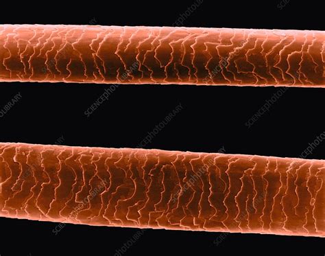 Fine Human Hair Sem Stock Image C0320010 Science Photo Library