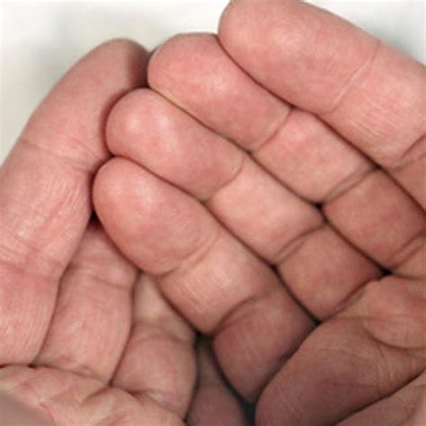 Arriba 74 imagen dolor en la yema de los dedos y uñas Thptletrongtan