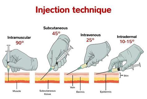 Medical Doctors Worldwide On Instagram Different Types Of Injection