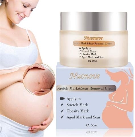 Top 10 Best Stretch Mark Creams For Pregnancy In The Uk 2021 Bio Oil Mama Mio And More Mybest