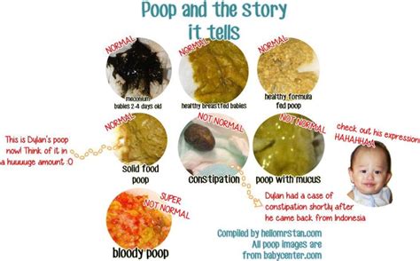 Pampers Special Parenting Tip Your Babys Poo Tells A Story Hello