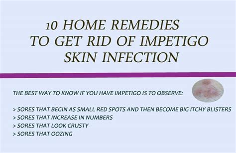 10 Simple Home Remedies To Get Rid Of Impetigo Skin Infection
