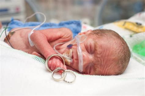 Professional Insight Documenting Your Babys Nicu Journey Through Photography Hand To Hold