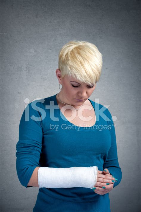 Woman With Arm In Cast Stock Photo Royalty Free Freeimages