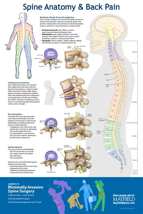 Spine Anatomy And Back Pain Poster Behance